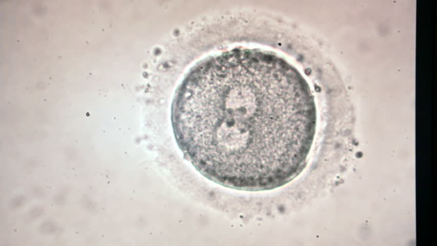 Financial domination humiliation See sperm microscope power