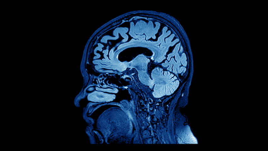 MRI Brain Scan Stock Footage Video 10098293 - Shutterstock