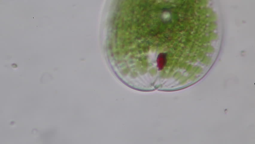 organism in a drop of water Bacterial plate cultures: with a sterile cooled loop, place a drop of sterile water or saline solution on the slide sterilize and cool the loop again and pick up a very small sample of a bacterial colony and gently stir into the drop of water/saline on the slide to create an emulsion. organism in a drop of water Bacterial plate cultures: with a sterile cooled loop, place a drop of sterile water or saline solution on the slide sterilize and cool the loop again and pick up a very small sample of a bacterial colony and gently stir into the drop of water/saline on the slide to create an emulsion.