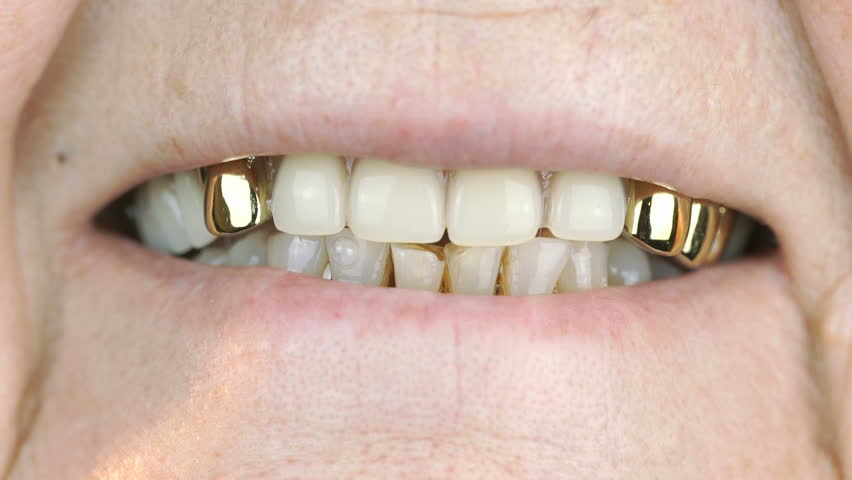 The Elderly Woman Smiling With False Teeth. Close Up Stock Footage ...