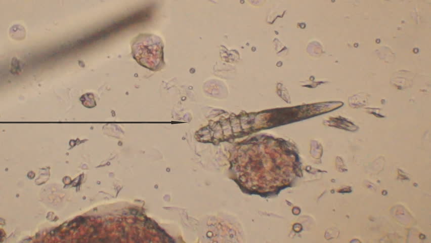 Pics For > Demodex Canis Egg