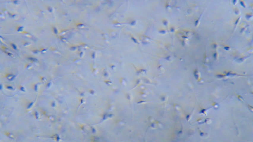 Sperm under microscope video Slub skin nude