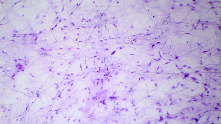Escherichia Coli Bacteria (E. Coli) Under Microscope, Magnification